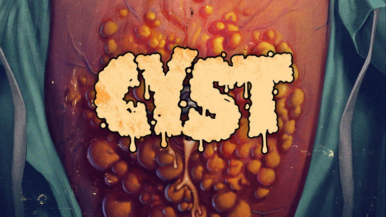 Fotograma de Cyst
